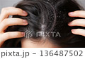 Hair care tips for dealing with dandruff in a home setting 136487502