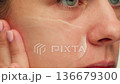 Woman apply cream for hands skin, Close-up of hands with exfoliating cream, demonstrating effective 136679300