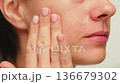 Woman apply cream for hands skin, Close-up of hands with exfoliating cream, demonstrating effective 136679302