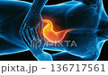 3DCG visualization of stomach pain and inflammation. Explanation of the mechanisms of gastritis and stomach ulcers (for vertical video) 136717561