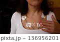 A woman shows Holter electrodes attached to her body  136956201