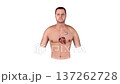 Cardiac Pacemaker Implantation in Male Chest with Visible Heart Anatomy 3D Medical Illustration 137262728