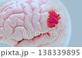 Brain damage or cancer tumor malignant cells growth and spreading. Can be used in medical elements related meningioma or neurological disease, 3D Render. 138339895