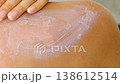Close-up of a hand applying cream onto peeling sunburned skin on a shoulder. The footage shows treatment and recovery after UV damage, useful for skincare advertising, dermatology topics, or sun 138612514