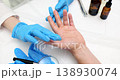 Doctor applies ointment oil to treat patient hand 138930074
