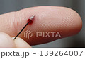 Man pricks a sore on his finger, and blood flows out, macro. Slow motion. 139264007