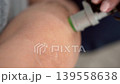 Vertical macro shot of alexandrite laser hair removal on leg close up of professional laser handpiece treating skin with cooling green light in aesthetic clinic 139558638