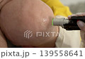 Vertical frame macro shot of alexandrite laser hair removal on bald head professional cosmetologist treating skin with cooling laser handpiece in aesthetic clinic 139558641