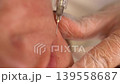 Close up of medical needle injection on woman face for skin rejuvenation and wrinkle filling professional cosmetologist performing aesthetic procedure in medical clinic 139558687