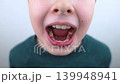 10 year old boy at pediatric dentist showing milk tooth extraction. Concept of caries treatment, physiological change of teeth and permanent teeth eruption in school age children. 10 year old boy at pediatric dentist showing milk tooth extraction. Concept of caries treatment, physiological change of teeth and permanent teeth eruption in school age children. 139948941