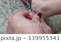Macro close up of damaged toenail trimming and foot care 139955341