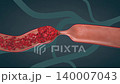 Narrowing artery from plaque buildup, restricting blood flow and raising heart risk - 3d illustration 140007043