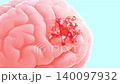 Brain damage or cancer tumor malignant cells growth and spreading. Designed to pastel color and minimal concept. Can be used in medical elements related meningioma or neurological disease, 3D Render. 140097932