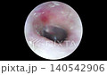 Ear cleaning video: Inside the ear 01 140542906