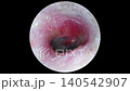 Ear cleaning video: Inside the ear 02 140542907