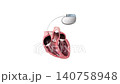 3D Animation for Educational Heart Anatomy, Biventricular Pacemaker Function Diagram, Cardiac Resynchronization Therapy CRT Explanation, Medical Diagnostics Illustration 140758948
