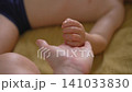 Child hand with red spots on finger bends. Close-up. 141033830