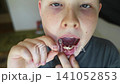 A 10-year-old boy shows a fresh empty socket in his lower jaw after losing a baby tooth. He holds the shed milk tooth in his hand, highlighting natural childhood development and dental growth. A 10-year-old boy shows a fresh empty socket in his lower jaw after losing a baby tooth. He holds the shed milk tooth in his hand, highlighting natural childhood development and dental growth. 141052853