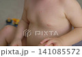 Three year old boy with red rash on face and body. Close-up. Slow motion. 141085572