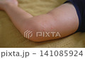 Red rash spots and small blisters near child knee. Close-up. 141085924
