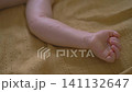 Child hand covered with red spots and small blisters. Close-up. 141132647