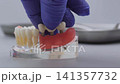 Dentist hand in blue glove placing dental bridge onto implant jaw model. Clinical prosthetics concept 141357732