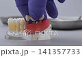Dentist hand in blue glove placing dental bridge on implant jaw model. Clinical prosthetics concept 141357733