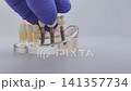 Dentist hand in blue glove placing dental bridge on implant jaw model. Dental prosthetics concept with copy space 141357734