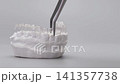 Placing clear orthodontic aligner on plaster dental model using tweezers. Invisible braces concept with copy space 141357738