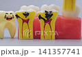 Dental Crown Removal and Placement Around Implant on Jaw Model 141357741