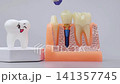 Educational concept of implantology, prosthodontics and tooth replacement. 141357745