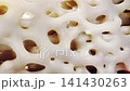 Osteoporosis and cartilage aging reduce knee bone density, causing joint pain and mobility loss. 3D animation of skeletal degeneration, mineral loss, and tissue thinning in the knee joint. 141430263