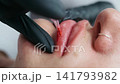 Macro Permanent Lip Tattoo Procedure 141793982
