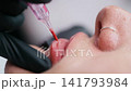 Macro Permanent Lip Tattoo Procedure 141793984
