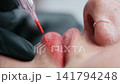 Macro Permanent Lip Tattoo Procedure 141794248