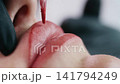 Macro Permanent Lip Tattoo Procedure 141794249