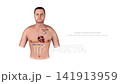 Biventricular Pacemaker Illustration for Heart Failure Patients, Anatomical Cardiac Pacing, Cardiac Resynchronization Therapy CRT , Chest and Heart Cross-Section Medical Diagram 141913959