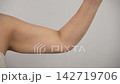 Female Upper Arm Close Up Flexing to Show Loose Skin and Flab 142719706