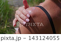 Woman Applying Sunscreen Lotion on Her Sunburned Shoulder Outdoors 143124055