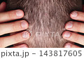 Closeup Top View Of Man Touching And Checking Thinning Hair On Crown Of Head. Early Signs Of Hair Loss, Male Baldness, Scalp Care And Hair Restoration Concept. 143817605