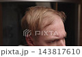 Worried Man Examining Receding Hairline And Balding Areas In Bathroom, Trying To Hide Hair Loss. Stress, Baldness Concern, Hair Care And Hair Transplant Concept. 143817610