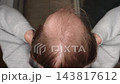 Top View Of Man Holding Head With Visible Bald Spot And Thinning Hair On Crown. Male Hair Loss, Baldness And Hair Restoration Concept. 143817612